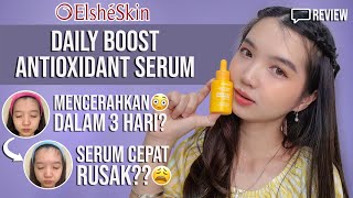 ELSHESKIN DAILY BOOST ANTIOXIDANT SERUM REVIEW  VITAMIN C 15 [upl. by Ettenowtna]