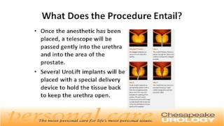 UroLift Procedure for BPH Chesapeake Urology [upl. by Dougherty986]