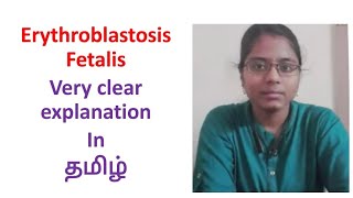 Erythroblastosis Fetalis in Tamil  Very clear explanation ✨ [upl. by Breskin]