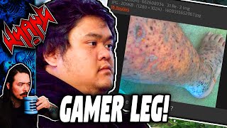 Gamer Leg  Tales From the Internet [upl. by Ramaj]