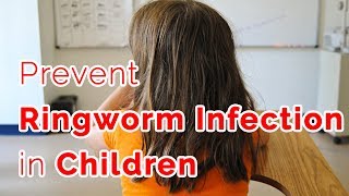 What causes ringworms in children  Dr Rajdeep Mysore [upl. by Ahsiema]