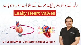 Leaky Heart Valves  Causes and Symptoms  HindiUrdu [upl. by Aible]