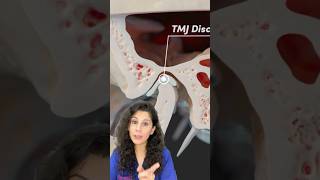 TMJ DISORDER  Ideal TMJ JOINT  TMJ pain shorts viralvideo trending tmj tmjdisorder tmjpain [upl. by Ayekel]