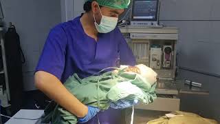 baby come out anesthesia craniosynostosis operation [upl. by Georgeanne200]