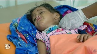 Diphtheria takes a deadly stranglehold on wartorn Yemen [upl. by Atahs]