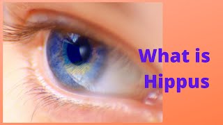 What is Hippus [upl. by Ambrosius414]