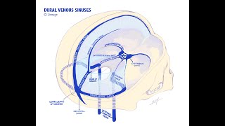 venous infarct case review [upl. by Ayeki681]