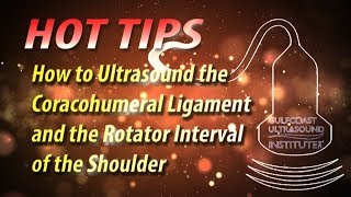 How to Ultrasound the Coracohumeral Ligament and Rotator Interval of the Shoulder [upl. by Rehotsirhc652]