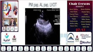 EPAC 24  S5  Utility of Intracardiac Echocardiography in EP Studies  Dr Shady Nakhla [upl. by Aicemaj]