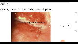 Trichomoniasis [upl. by Servetnick]