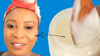 How to use aloe vera gel to get rid of dry skin large pores black heads and hyperpigmentation [upl. by Erlandson]