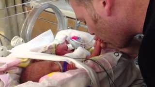 Preemie born at 27 weeks plays with her Daddy [upl. by Jerrine724]