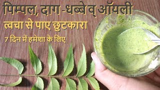 Pimple Daag Dhabbe व Oily Skin से पाए छुटकारा पाए हमेशा के लिए How To Remove Pimple Pimple Marks [upl. by Yelsha]