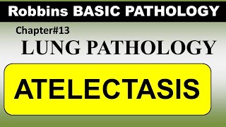 Chp13 Robbins Patho  Lung Pathology  ATELECTASIS [upl. by Assenar]