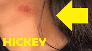 how to give someone a hickey on the neck easy [upl. by Aerehs]