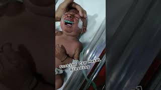 Nasal Blocked Suction after nasal bleeding shorts viralvideo cutebaby baby newborn [upl. by Olli]