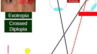 22 Measurement of angle of deviation Subjective Tests [upl. by Onofredo95]