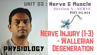 PHY03021 Nerve injury 13  Wallerian Degeneration  Dr Prashant Sharma [upl. by Dunton]