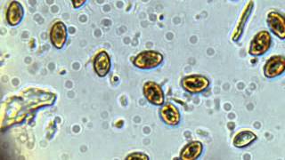 Spores Under Microscope [upl. by Erhart]