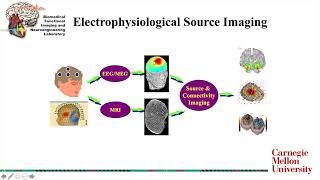 Electrophysiological Source Imaging Recent Adv amp Applications to Brain Mapping amp Neural Interfacing [upl. by Holna]