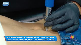 BG  Intradermoterapia pressurizada trata gordura localizada [upl. by Nnayrb]