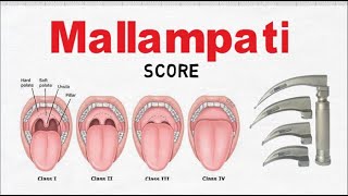 Mallampati Score  Airway Assessment [upl. by Sheeree]