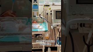 Neonatal Invasive Ventilation shorts Ytshorts Nursing knowledge with wisdom [upl. by Eivad346]