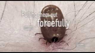 The truth about ticks [upl. by Fredrika]