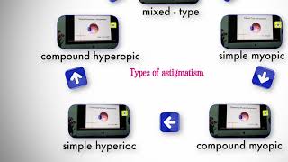 Types of astigmatism [upl. by Vera324]