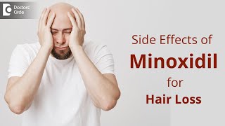 Side effects of Minoxidil for Hair Loss  TIPS to Deal This  Dr Deepak P Devakar  Doctors Circle [upl. by Sherwin]