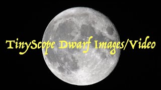 TinyScope Dwarf Images and Video [upl. by Airpal]