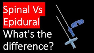 Whats the difference between spinal and epidural anaesthesia [upl. by Yelha]