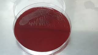 Streptococcus agalactiae colony characteristics on blood agar of Urine Culture [upl. by Kriss359]