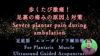 Severe plantar pain during ambulation Ultrasoundguided acupuncture treatment for Plantaris Muscle [upl. by Malloch944]