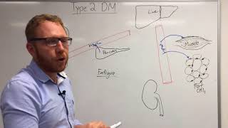 Type 2 Diabetes Pathophysiology [upl. by Dniren]