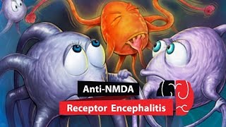 Anti NMDA Receptor Encephalitis [upl. by Ecyor349]