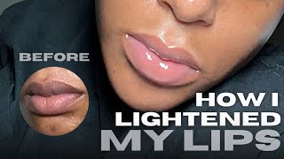 HOW I LIGHTENED MY LIPS IN ONE MONTH USING ONE KEY INGREDIENT [upl. by Stacy]