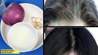 Sólo Con Estos 3 Ingredientes Eliminará Las Canas Y Evitará La Caída Del Pelo [upl. by Dillie670]