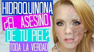 HIDROQUINONA CAUSA CÁNCER REALMENTE ACLARA LAS MANCHAS Paola Herrea [upl. by Aitenev]