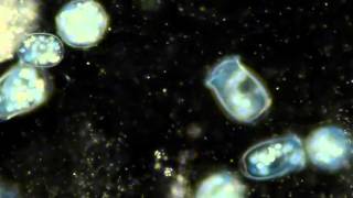 Protozoa Vorticella video [upl. by Olwen]