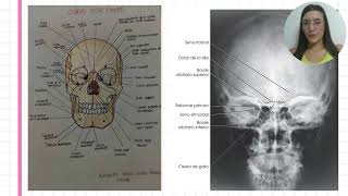 Cráneo  Comparación [upl. by Binni]