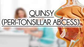 QUINSY PERITONSILLAR ABCESS [upl. by Nazay]