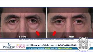 Plexaderm Skincare TV Commercial  Tighten Lift and Transform tvcommercials plexaderm skincare [upl. by Knoll]