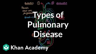 Types of pulmonary diseases  Respiratory system diseases  NCLEXRN  Khan Academy [upl. by Ahsercal]