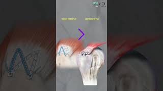 Supraspinatus Tear के बाद से कैसे बचें Shoulder Replacement से  How to Prevent Arthritis [upl. by Suoinuj507]