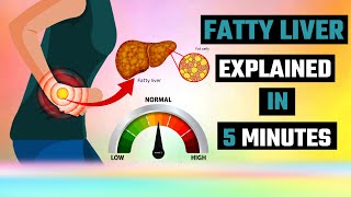 The Shocking Fatty Liver Truth EXPERTS Are Hiding [upl. by Brahear853]