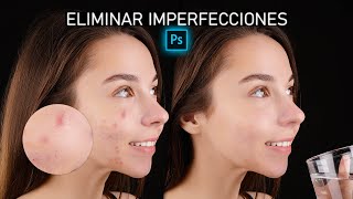 Eliminar IMPERFECCIONES de la CARA Photoshop 🔵 Quitar Manchas PIEL [upl. by Glynnis450]