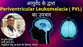 Periventricular Leukomalacia  Causes Symptoms and Treatment in Ayurveda  डॉ पुनीत द्विवेदी [upl. by Dwain]