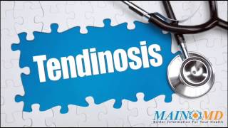 Tendinosis ¦ Treatment and Symptoms [upl. by Martina396]