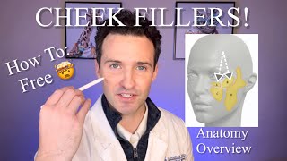 Cheek Fillers Feminine face My technique [upl. by Cleres]